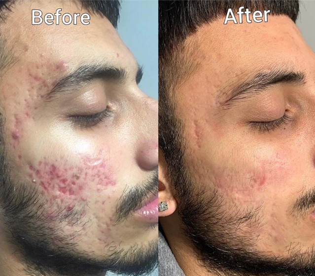 Organic Herbs immunity Booster